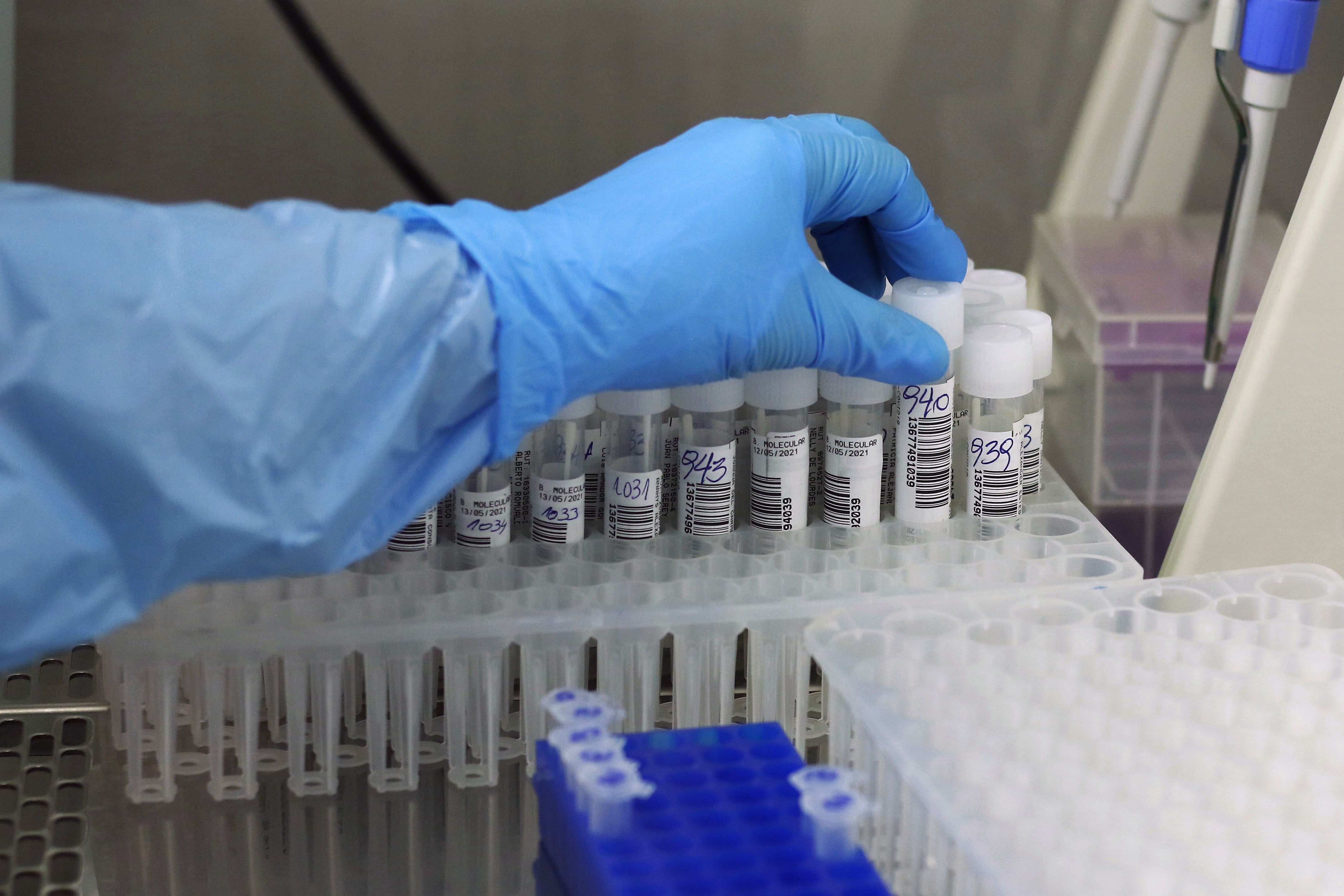 Valparaiso: Inauguran Laboratorio De Biologia Molecular Para Procesar Testos Pcr