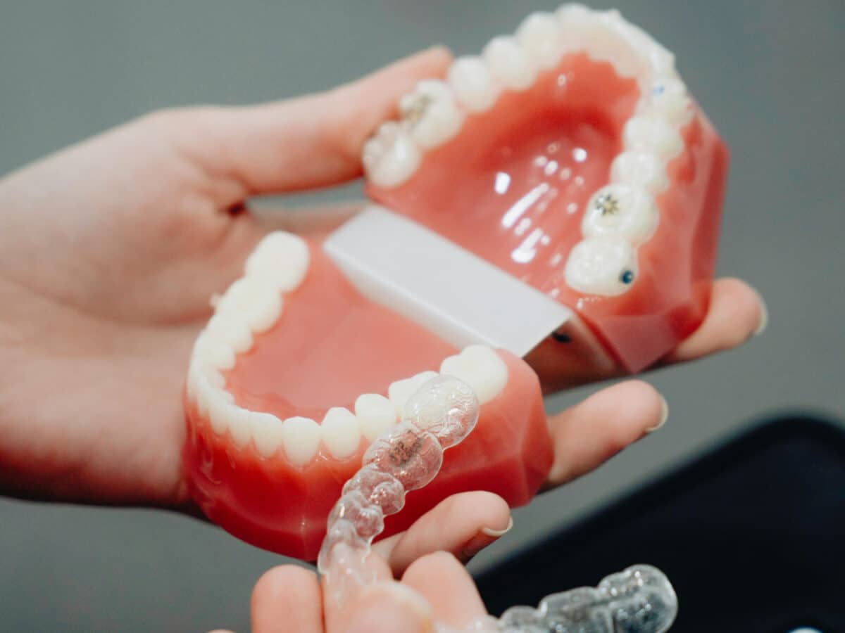 Hasta la pérdida de dientes: Expertos advierten sobre peligros por estafas de tratamientos de ortodoncia